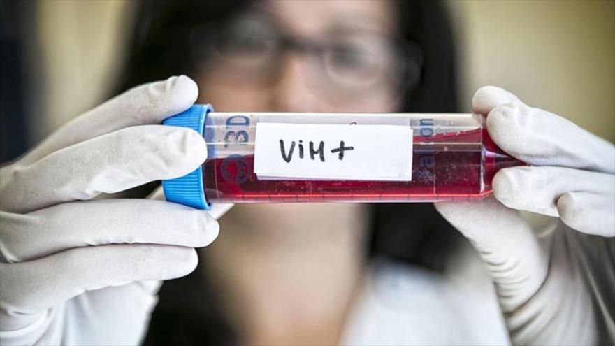 Tercer caso en el mundo de cura del VIH tras un trasplante de células madre imagen-1