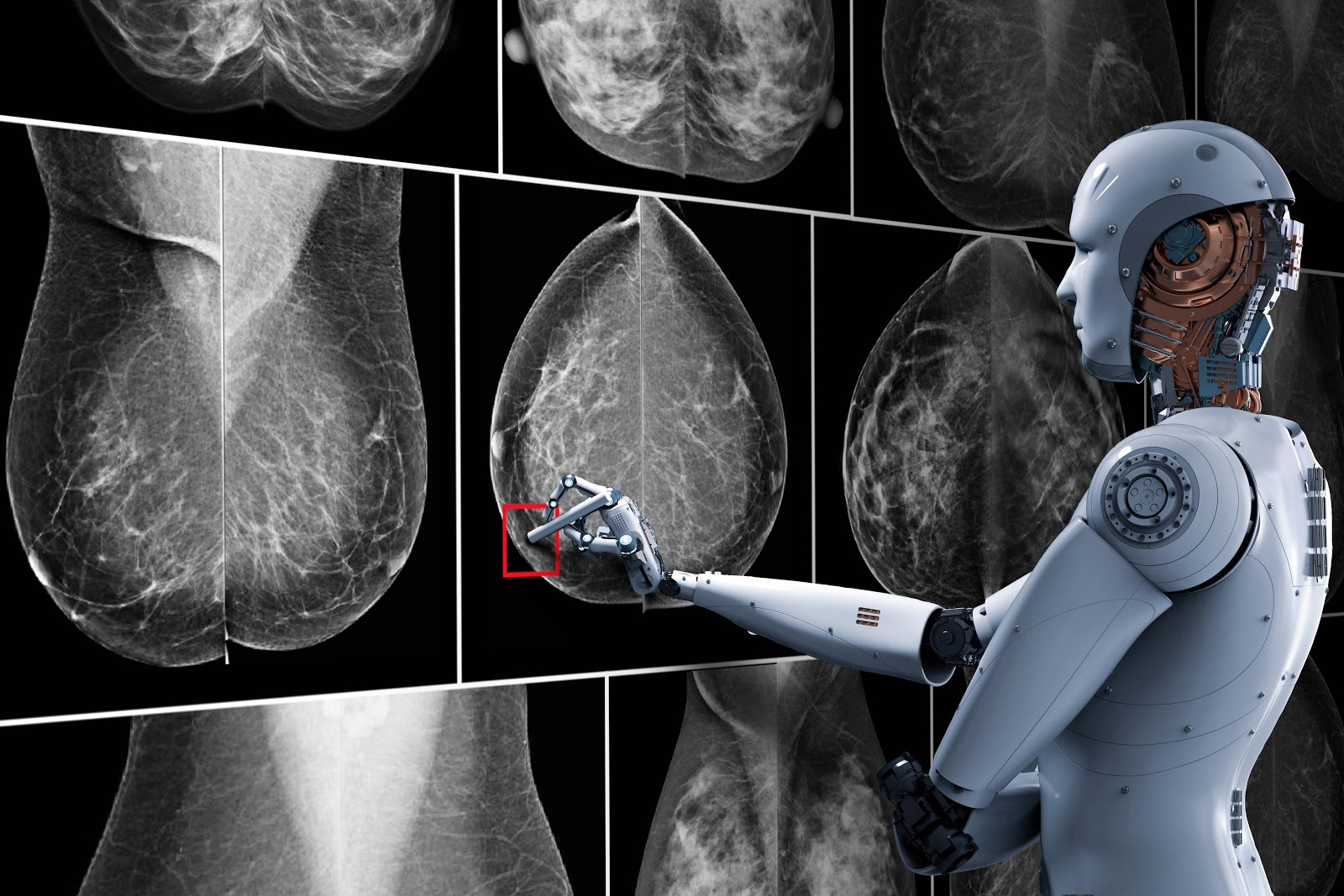 La Inteligencia Artificial podría predecir casos de cáncer de mama imagen-1