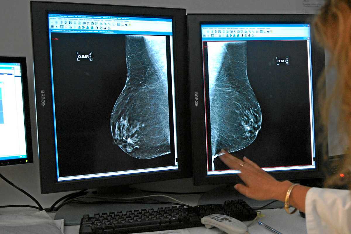 La Inteligencia Artificial podría predecir casos de cáncer de mama imagen-2