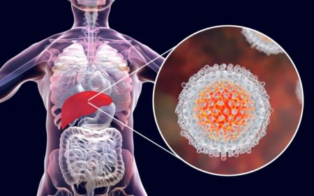 Remarcan la importancia de la detección precoz de la hepatitis C para prevenir complicaciones y contagios imagen-2