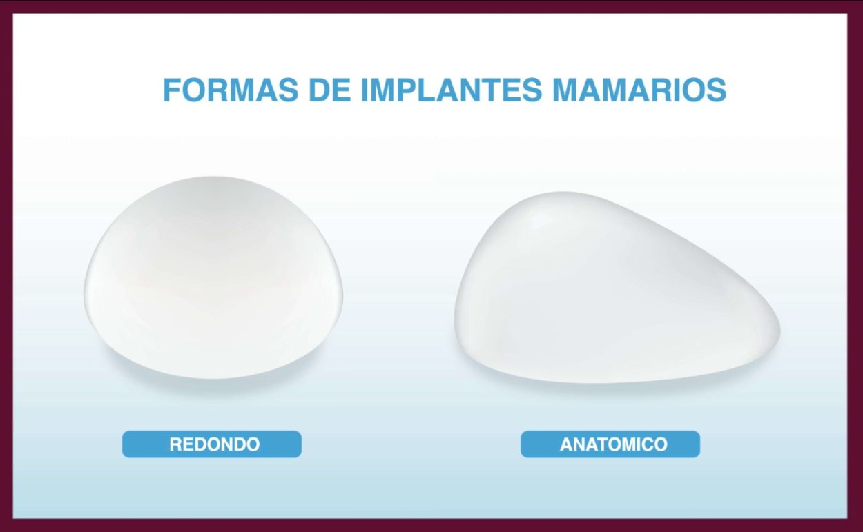 Mamis Misioneras: Todo lo que tenes saber sobre implantes mamarios imagen-2