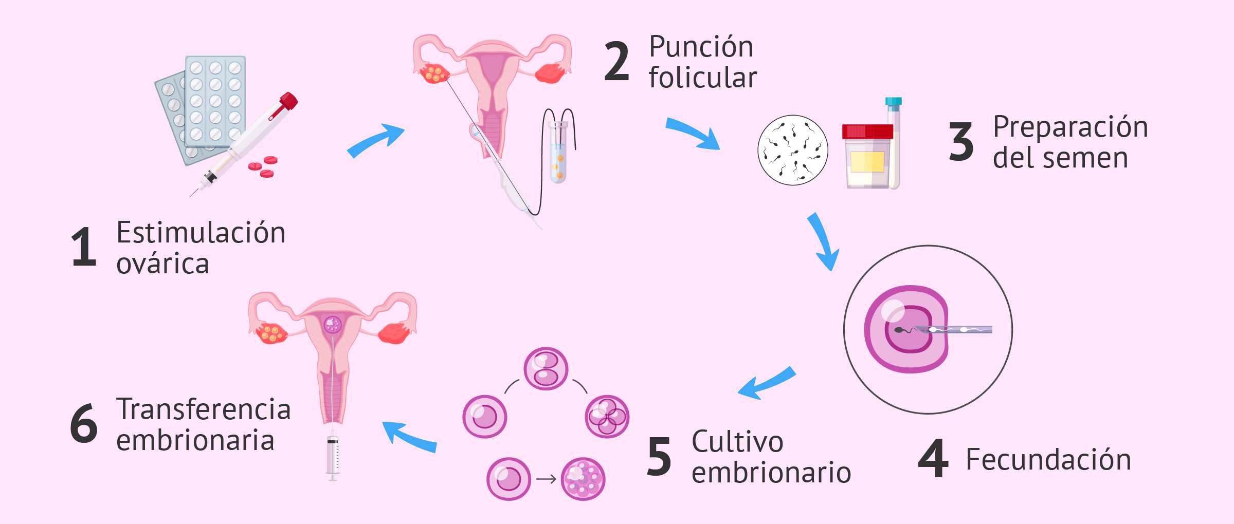 Tras el Día Mundial de la Fertilidad, explican de qué trata la Inseminación Intrauterina y la Fertilización In Vitro imagen-4