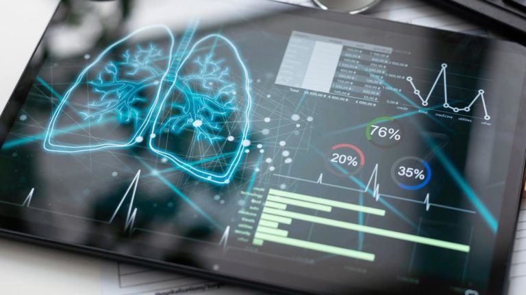 Fibrosis quística: afecta a 3000 personas y su detección precoz es clave imagen-40