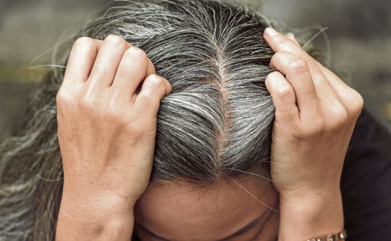 No tiene que ver con la edad: cuál es el origen de las canas, según Harvard imagen-13