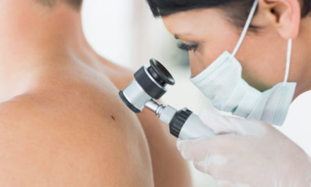 Dermatólogos recomiendan realizarse chequeos periódicos para prevenir el cáncer de piel imagen-2
