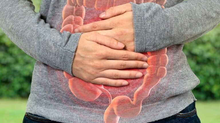 Gastroenterólogo explica qué es la diverticulitis, la condición que afectó al Gobernador de Misiones imagen-39