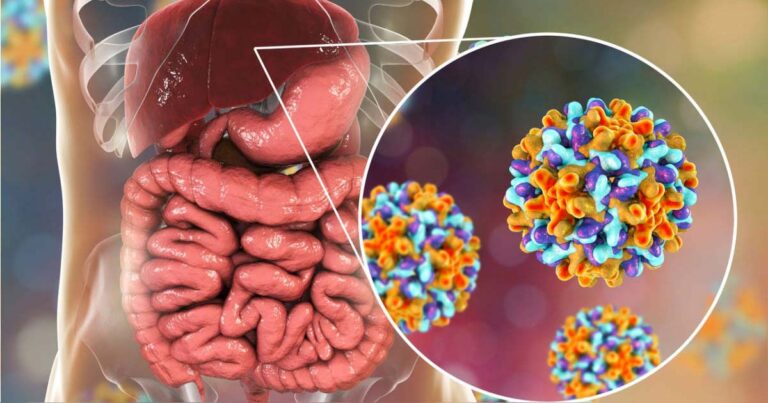 Día Mundial de la Hepatitis: por qué está subdiagnosticada y cuáles son los últimos avances para su tratamiento imagen-16