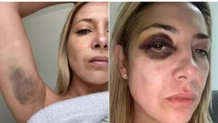 Denuncia contra Alberto Fernández: las fotos y chats de la violencia contra Fabiola Yañez Denuncia contra Alberto Fernández: las fotos y chats de la violencia contra Fabiola Yañez imagen-4