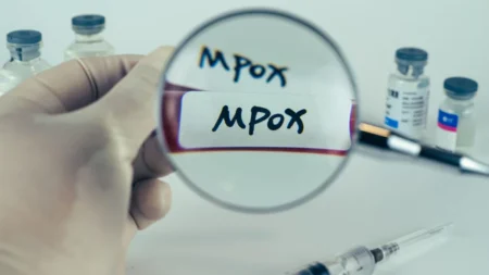 Viruela símica: cómo se contagia el virus mpox y cuántos diagnosticados hay en Argentina imagen-4