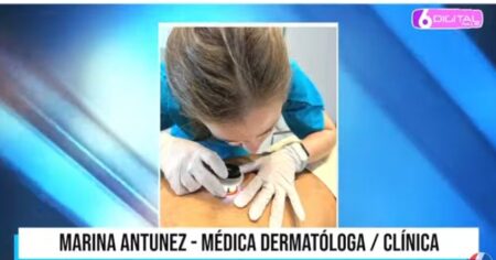 Cáncer de Piel: control de lunares, la regla del "Abcde" como método de prevención y qué es el "patito feo" imagen-6