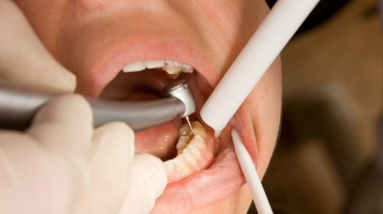 Odontólogo advirtió sobre la falta de información sobre salud bucal, "los controles regulares son clave prevenir lesiones e infecciones" imagen-40