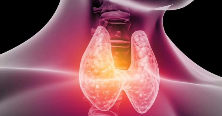 Día Mundial de la Tiroides: cuándo consultar y qué opciones ofrece hoy la medicina imagen-42