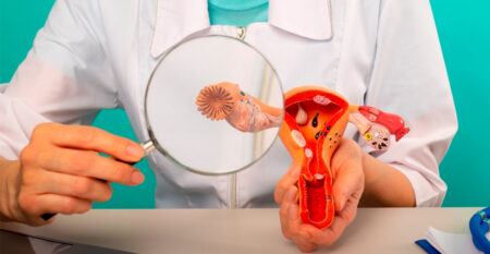 El 70% de los casos de cáncer de ovarios se detecta en estadios avanzados: cómo prevenir imagen-4