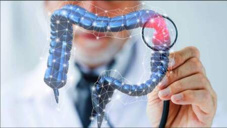 Cáncer de colon: Argentina lidera las tasas de incidencia en la región y dos síndromes hereditarios aumentan el riesgo Cáncer de colon: Argentina lidera las tasas de incidencia en la región y dos síndromes hereditarios aumentan el riesgo imagen-3