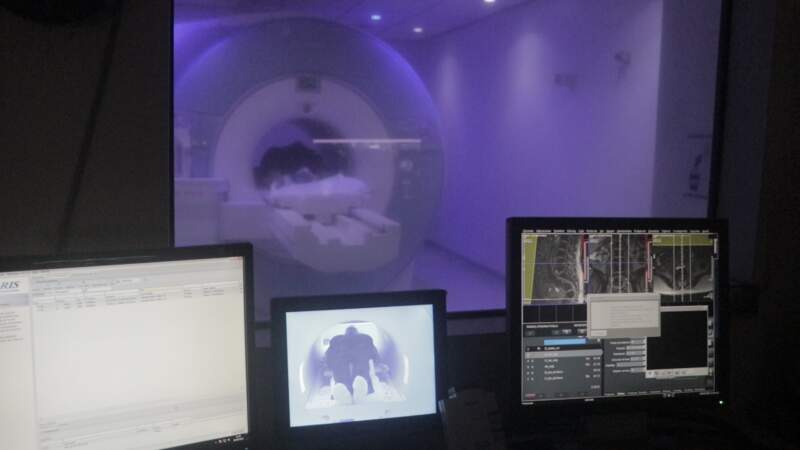 El Hospital Escuela realiza la innovadora cirugía de epilepsia receptiva, de desconexión y terapia de inmunomodulación 5 El Hospital Escuela realiza la innovadora cirugía de epilepsia receptiva, de desconexión y terapia de inmunomodulación imagen-4