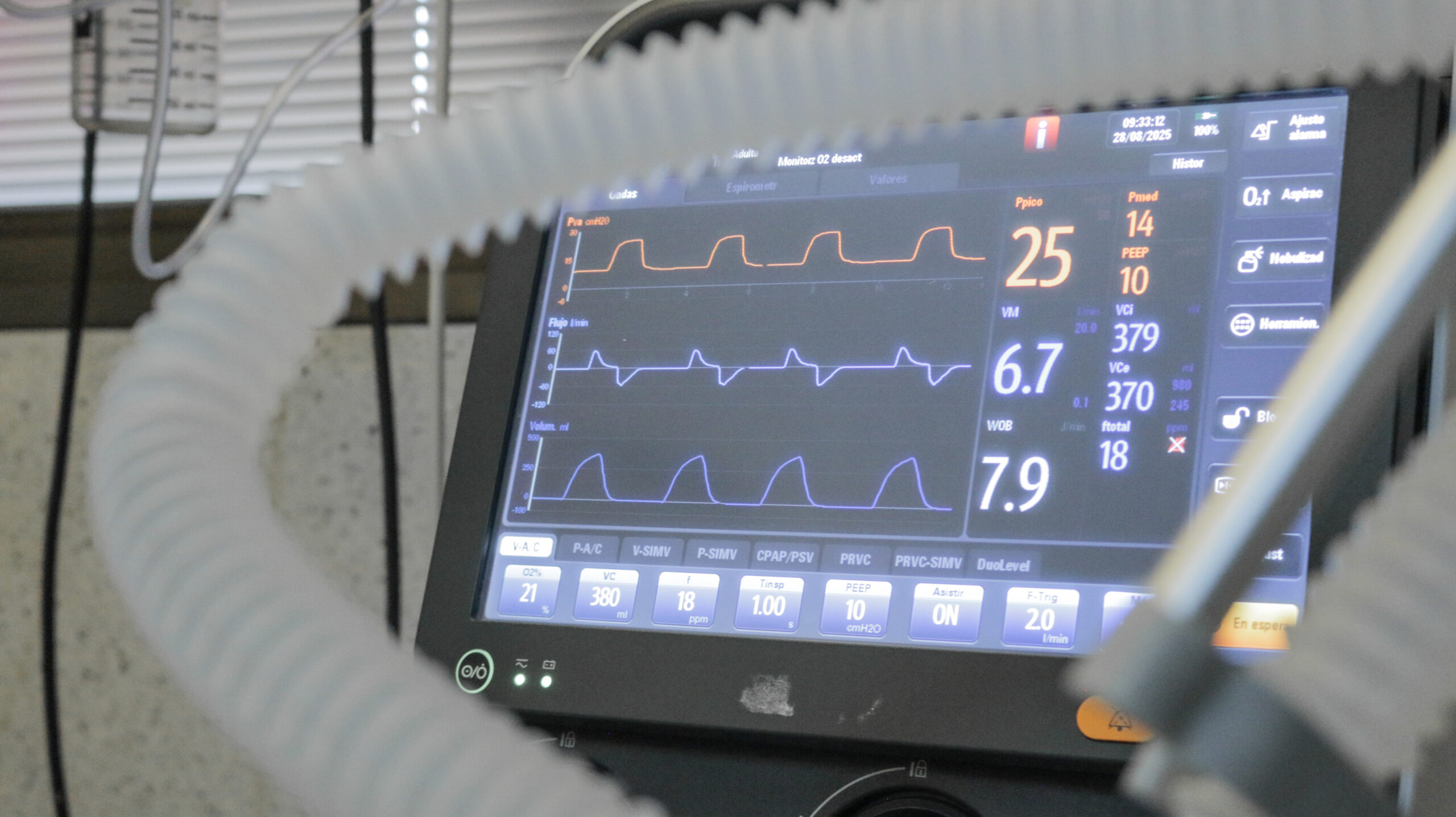  Nuevas camas ortopédicas fortalecen la UTI del Hospital Madariaga para una atención más segura y confortable imagen-14