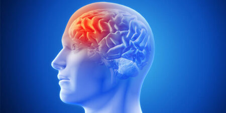 Día Internacional de Acción contra la Migraña: 5 recomendaciones para mejorar la calidad de vida imagen-2