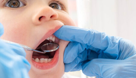 Cómo prevenir caries y problemas de mordida en los niños: la odontóloga López explicó la importancia de la atención temprana y la ortopedia dental imagen-10