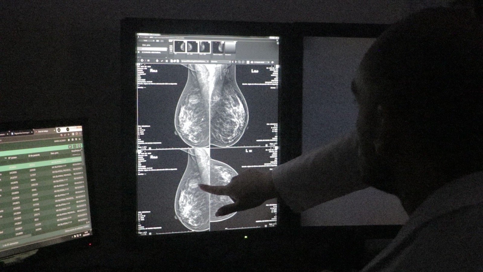 Octubre Rosa: “El diagnóstico temprano brinda posibilidades curativas del cáncer”, afirmó el doctor Gabriel Rabinovich imagen-2