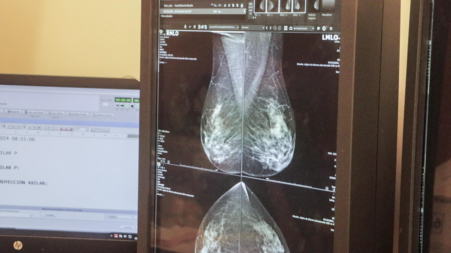 Octubre Rosa: El Hospital Madariaga invita a las mujeres a realizarse estudios ginecológicos y mamográficos imagen-4