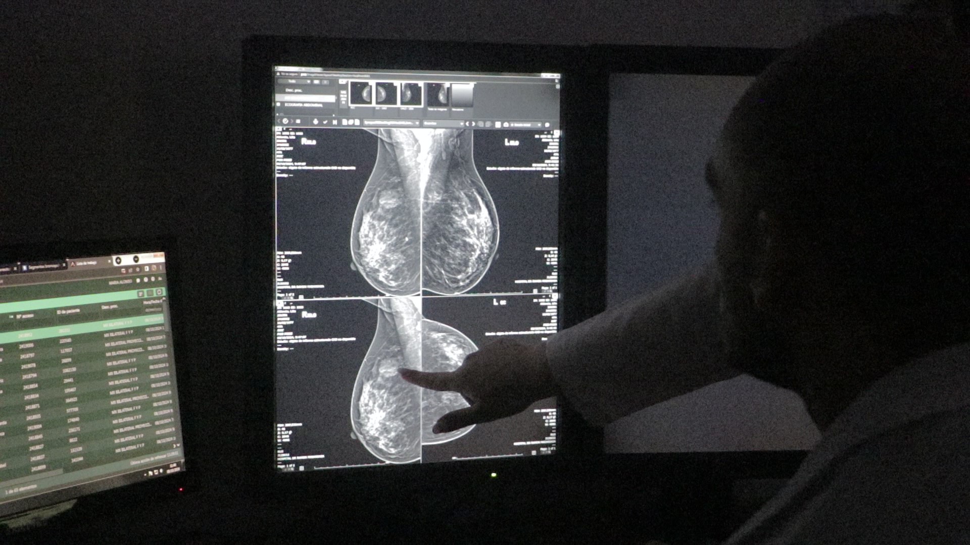 Octubre Rosa: El Hospital Madariaga invita a las mujeres a realizarse estudios ginecológicos y mamográficos imagen-6