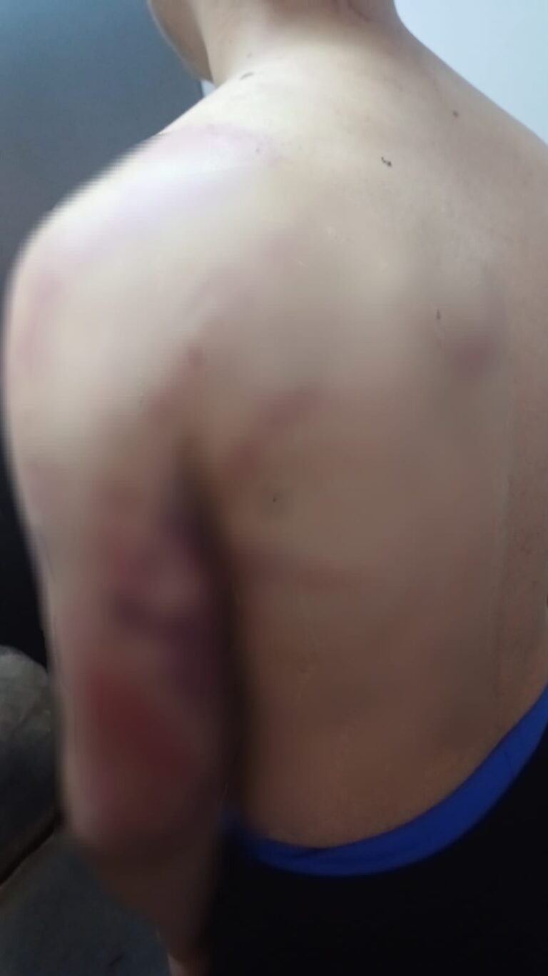 Golpeó brutalmente a su hijo y ahora es intensamente buscado por la Policía imagen-22