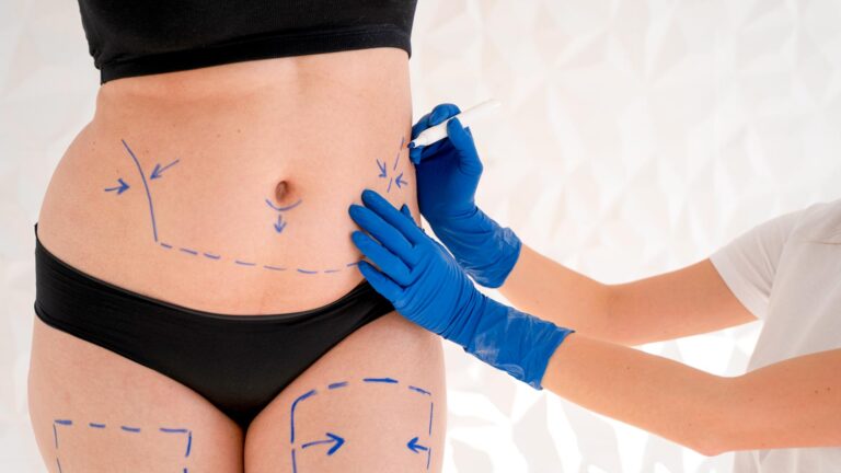 Dr. Cuotas: la plataforma que permite financiar cirugías estéticas y tratamientos en todo el NEA imagen-40