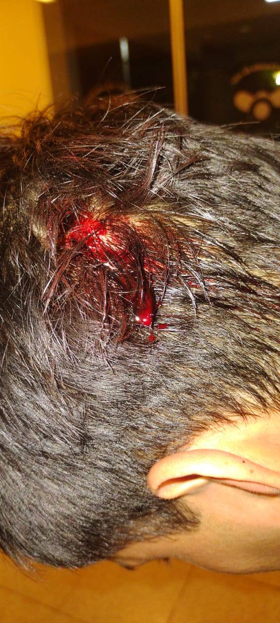 Violento desorden en la Chacra 145 dejó dos policías lesionados y un detenido 7 Violento desorden en la Chacra 145 dejó dos policías lesionados y un detenido imagen-6