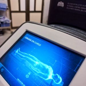 El Robot Da Vinci marca un nuevo hito quirúrgico en el Hospital Madariaga con una cirugía urológica única en el país 9 El Robot Da Vinci marca un nuevo hito quirúrgico en el Hospital Madariaga con una cirugía urológica única en el país imagen-8