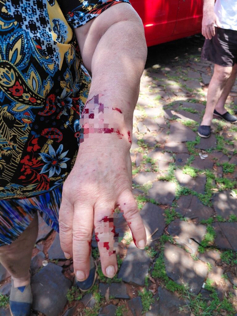 Dos mujeres fueron hospitalizadas tras ser atacadas por perros en Posadas imagen-13