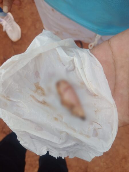 Una adolescente atacó con un cuchillo a una mujer y le arrancó parte de la oreja en Posadas Una adolescente atacó con un cuchillo a una mujer y le arrancó parte de la oreja en Posadas imagen-4