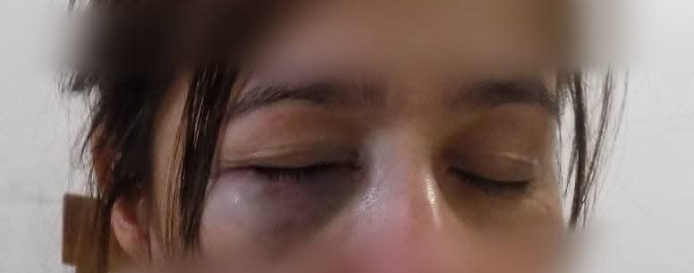 Dos mujeres fueron detenidas luego de lesionar a una vecina e intentarle sustraerle una moto 3 Dos mujeres fueron detenidas luego de lesionar a una vecina e intentarle sustraerle una moto imagen-2