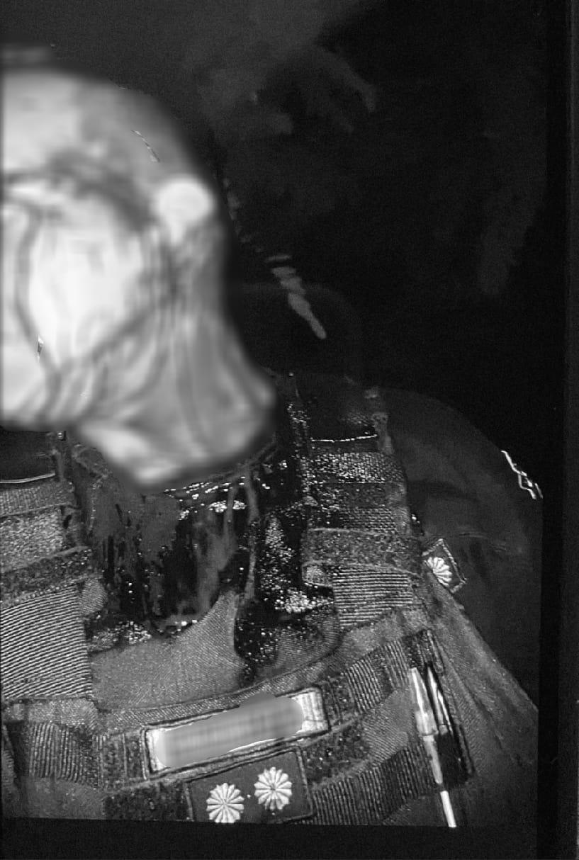 Un hombre atacó a su madre y causó cortes a un policía que intervino para protegerla 3 Un hombre atacó a su madre y causó cortes a un policía que intervino para protegerla imagen-2