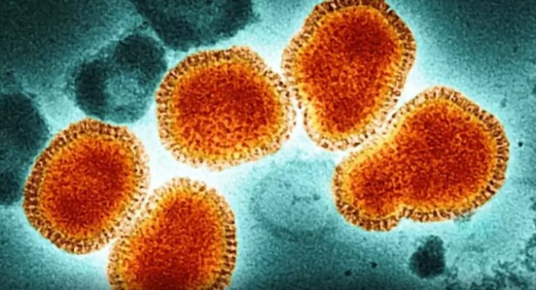 Alerta mundial por el brote de la "super gripe" H3N2 que ya ataca a Estados Unidos y Europa imagen-21