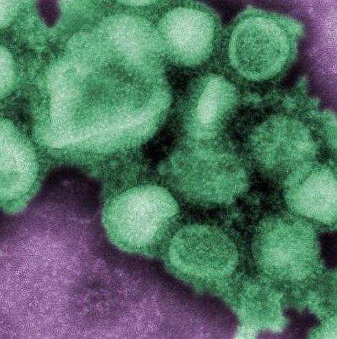 Salud de Nación brindó recomendaciones frente a la nueva variante de Influenza A (H3N2) imagen-17