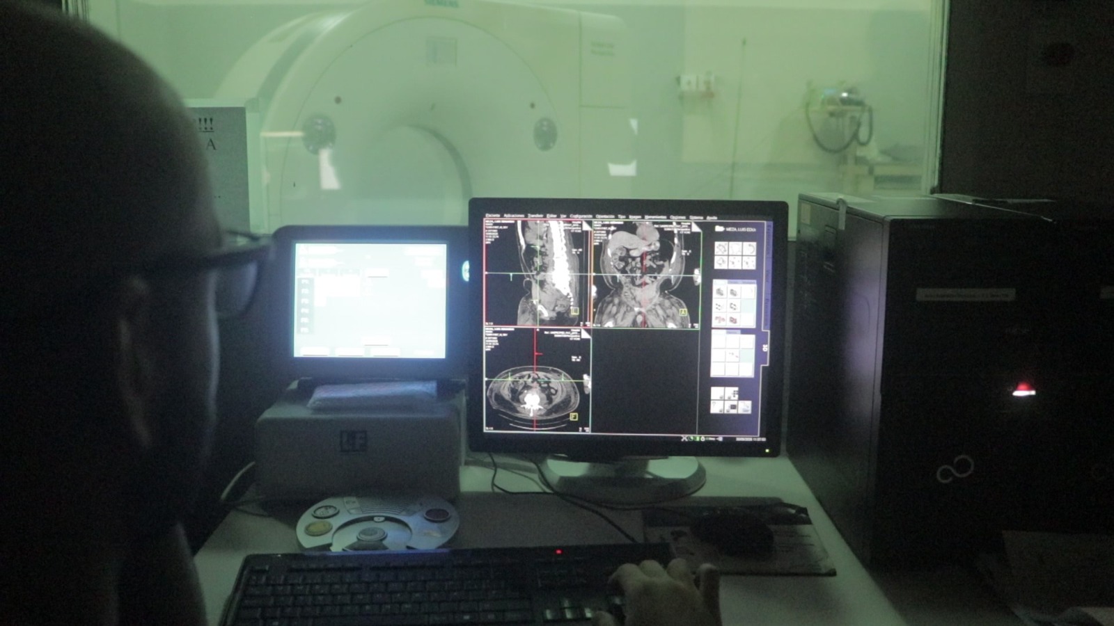 El Madariaga incorpora tecnología alemana y realiza una millonaria inversión en resonadores para reforzar el diagnóstico por imágenes 15 El Madariaga incorpora tecnología alemana y realiza una millonaria inversión en resonadores para reforzar el diagnóstico por imágenes imagen-14
