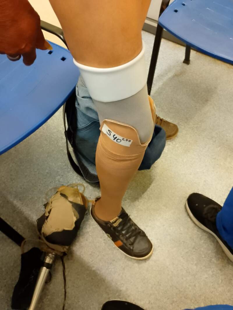 Parque de la Salud: El Banco de Prótesis cerró 2025 con 120 entregas y refuerza la cobertura con pacientes de toda la provincia imagen-18