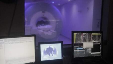 El Madariaga innovó con la cirugía de Epilepsia y terapias alternativas imagen-11