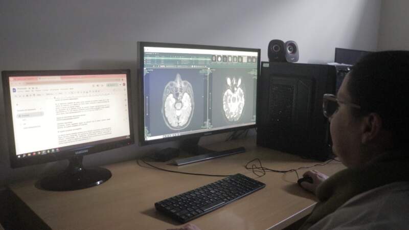 El Madariaga innovó con la cirugía de Epilepsia y terapias alternativas imagen-6