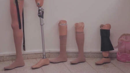 Parque de la Salud: El Banco de Prótesis cerró 2025 con 120 entregas y refuerza la cobertura con pacientes de toda la provincia imagen-3