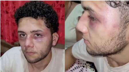 Eldorado: un trabajador denunció haber sido violentamente atacado por sus jefes imagen-4