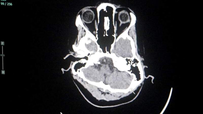 El Madariaga se posicionó como centro de referencia de atención de patologías neurológicas de alta complejidad imagen-10