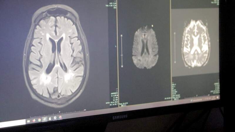 El Madariaga se posicionó como centro de referencia de atención de patologías neurológicas de alta complejidad imagen-8