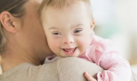 Acompañamiento, controles médicos y entorno familiar: pilares para la calidad de vida en el Síndrome de Down imagen-5