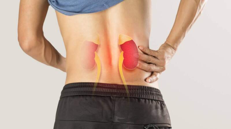 Enfermedad renal: qué señales tener en cuenta, cómo influyen la dieta y los hábitos, y cuándo es necesario iniciar tratamientos como la diálisis imagen-19