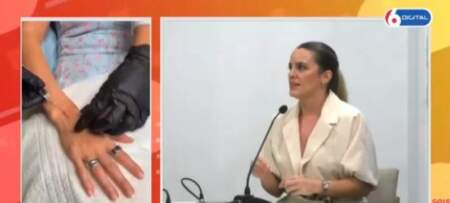 Las manos, la edad que no se puede esconder: el nuevo foco de la medicina estética imagen-11