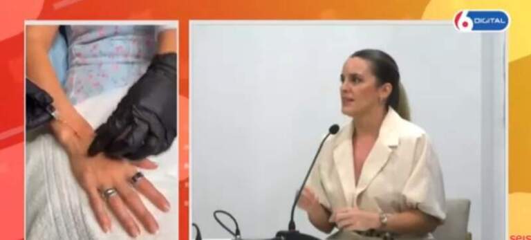 Las manos, la edad que no se puede esconder: el nuevo foco de la medicina estética imagen-45