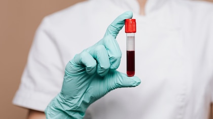 Día Mundial de la Hemofilia: por qué un simple golpe puede volverse un riesgo serio imagen-4