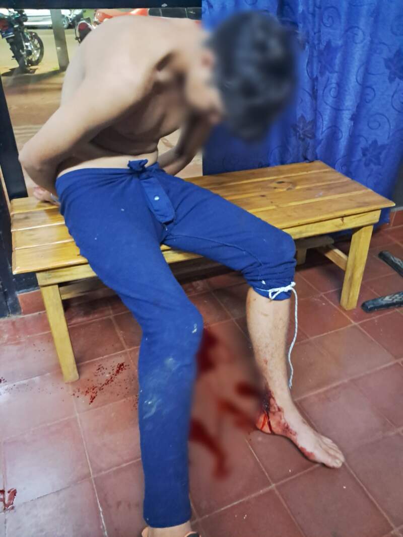 Quedó colgado del alambre al intentar robar y la Policía lo encontró herido y oculto en un baldío imagen-8