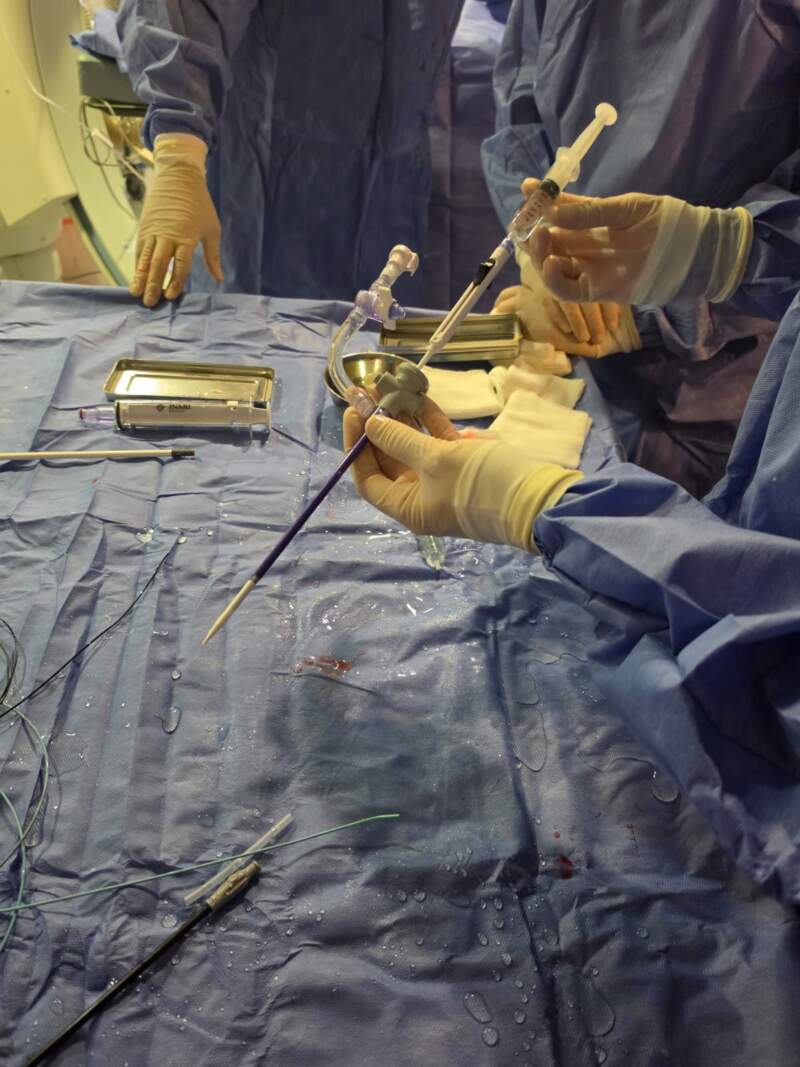 Hito sin precedentes: el Madariaga realizó la primera tromboaspiración pulmonar del NEA y cambió un pronóstico crítico imagen-3